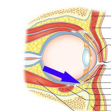 eyelid retractors