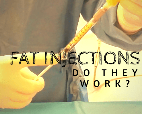 dr. brett kotlus fat grafting nyc