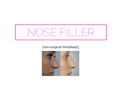 dr. brett kotlus nonsurgical rhinoplasty