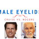 dr. brett kotlus male eyelid lift