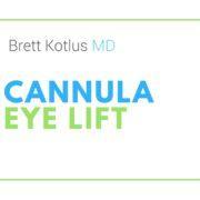 dr. brett kotlus cannula eye restylane