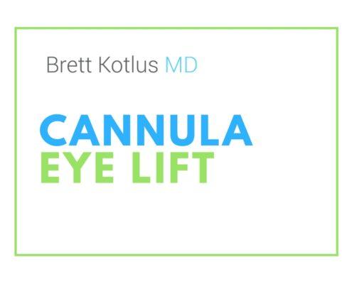 dr. brett kotlus cannula eye restylane
