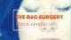 kotlus transconjunctival eye bag surgery