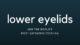 Blepharoplasty Lower Eyelids