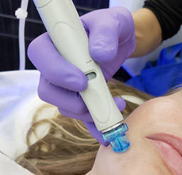 Hydrafacial Skin Cleansing