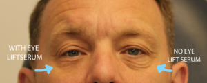 tensate eye lift